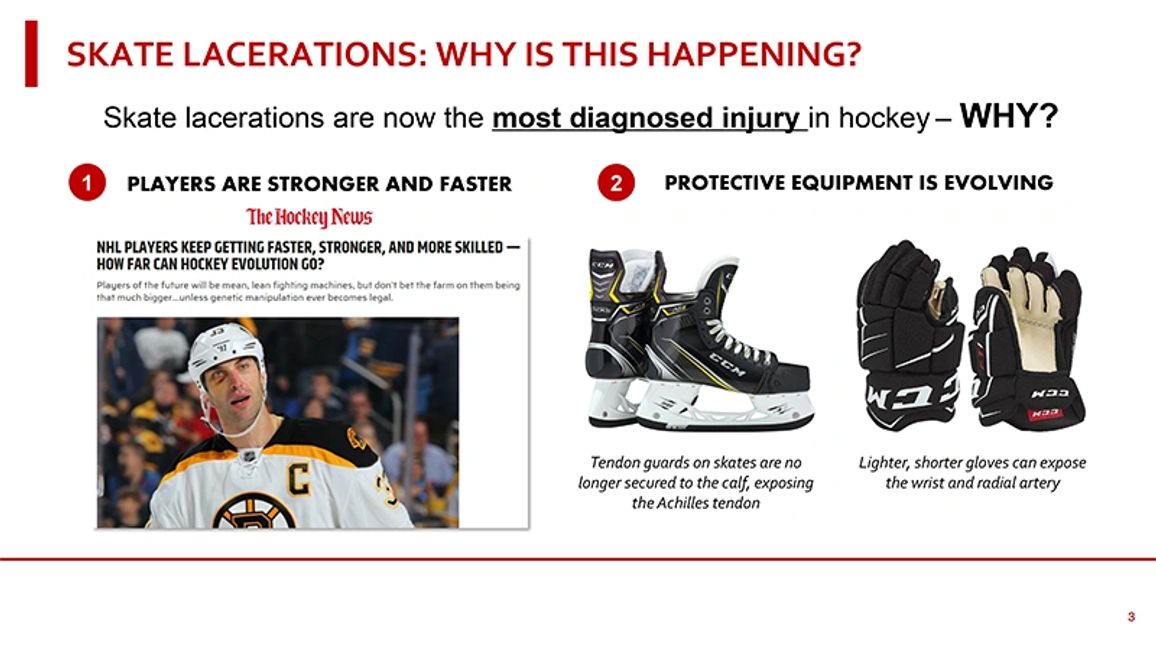 Why More Skate Cuts? SAFE>GAPS Inc.